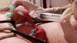 Needles Hard-on Cure